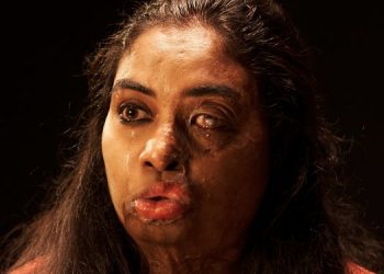 JOY Personal Care empowers acid attack survivors with new campaign
