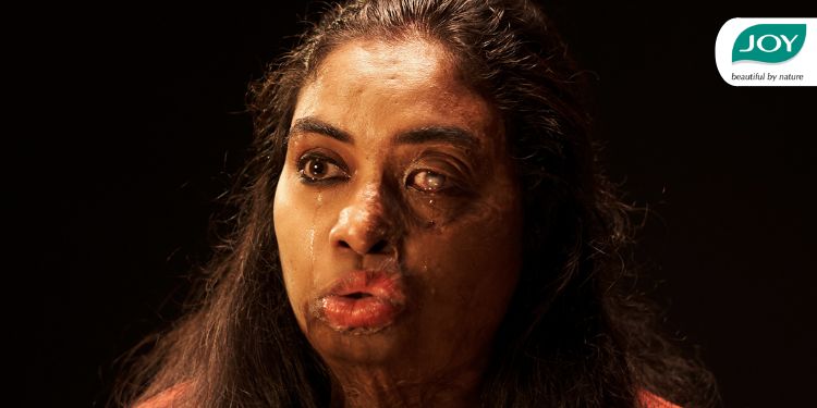JOY Personal Care empowers acid attack survivors with new campaign