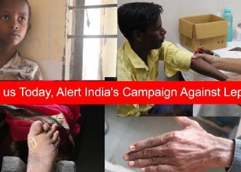 Riyo Advertising and ALERT-INDIA launch video campaign on Leprosy Awareness