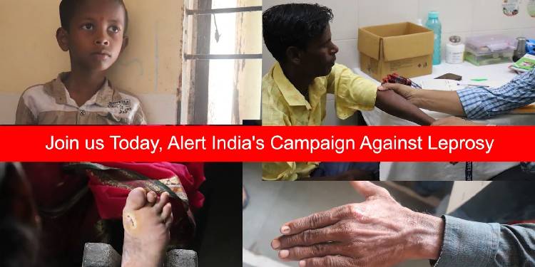Riyo Advertising and ALERT-INDIA launch video campaign on Leprosy Awareness